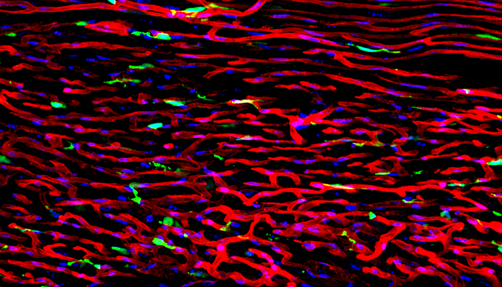 endothelial-cells-clara